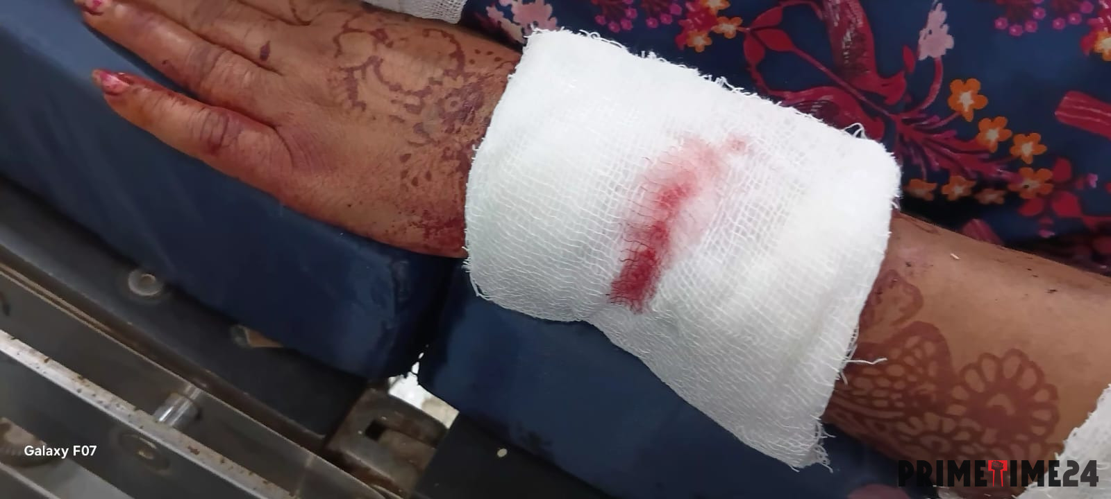 महिला को आरी से मारने का प्रयास