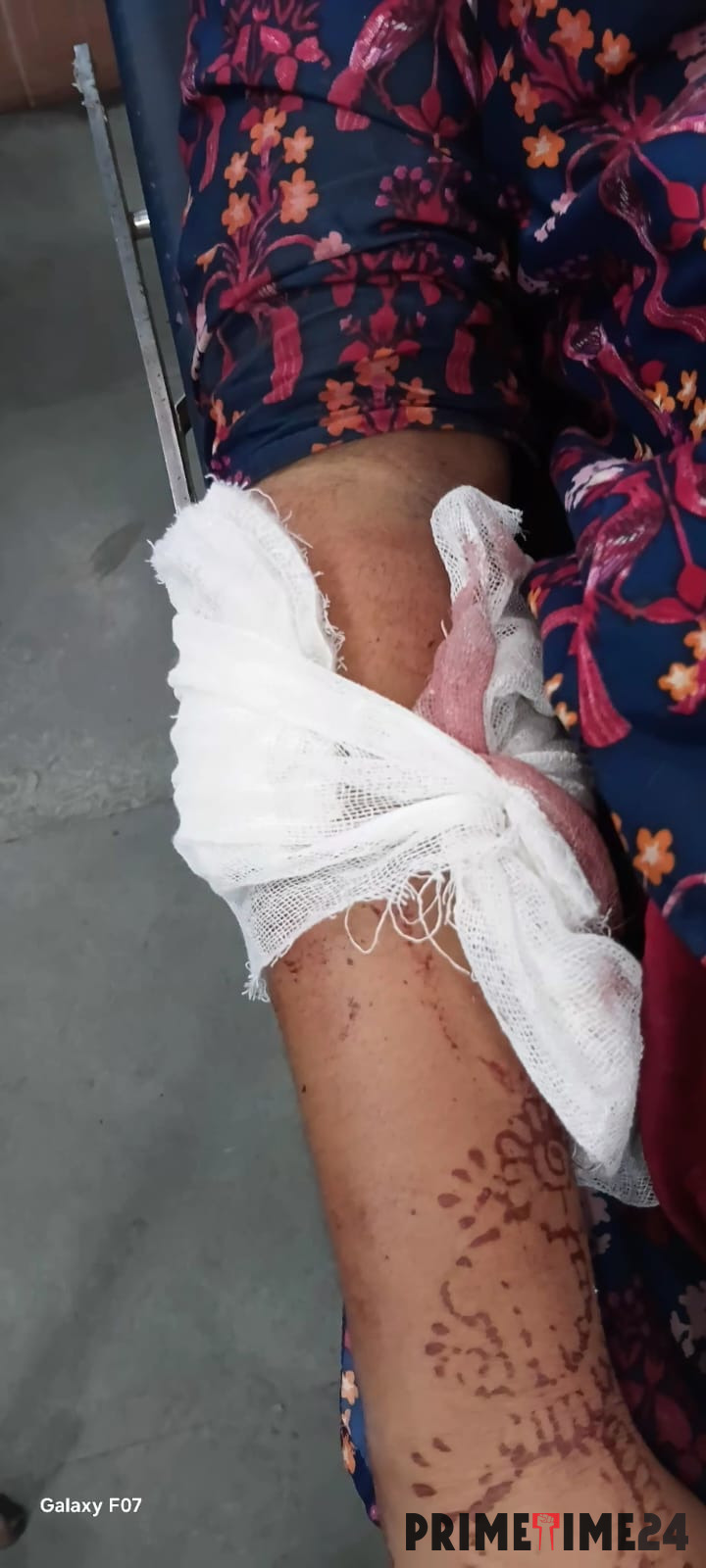 महिला को आरी से मारने का प्रयास